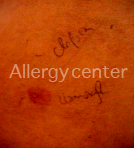 allergycenter