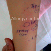 allergycenter