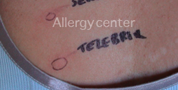 allergycenter