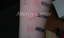 allergycenter