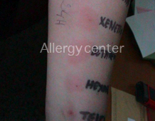 allergycenter