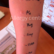 allergycenter