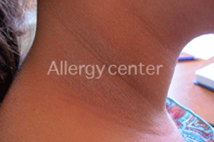 alergy-center