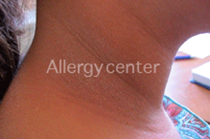 alergy-center alergy-center
