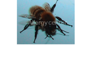 allergies-aux-venins-d’insectes allergies-aux-venins-d’insectes